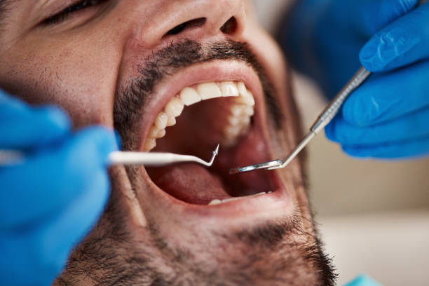 Best Emergency Tooth Extraction in Oreana, IL